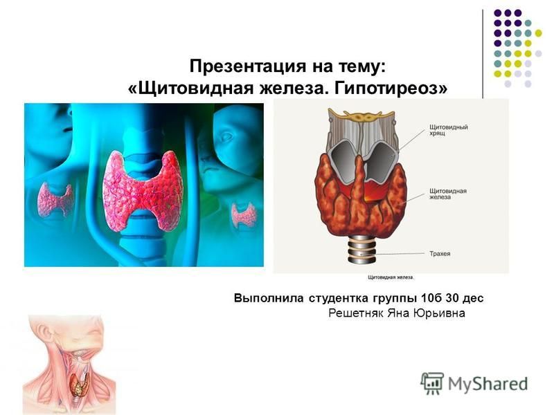 Эндокринология щитовидной железы. Гипотиреоз презентация. Щитовидная железа схема. Строение щитовидной железы в организме.