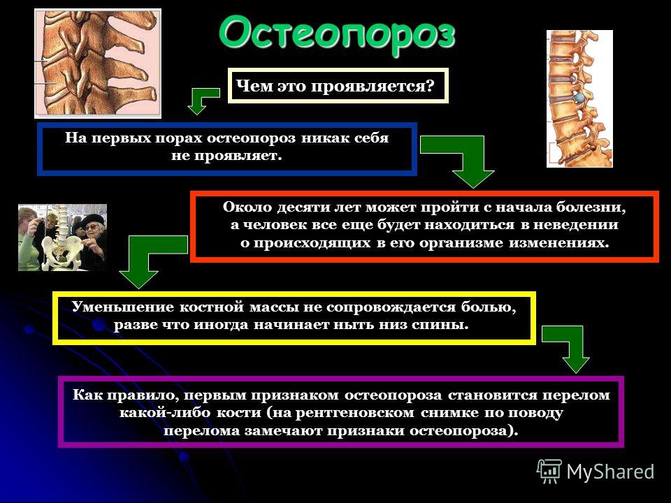 Остеопороз лечение презентация