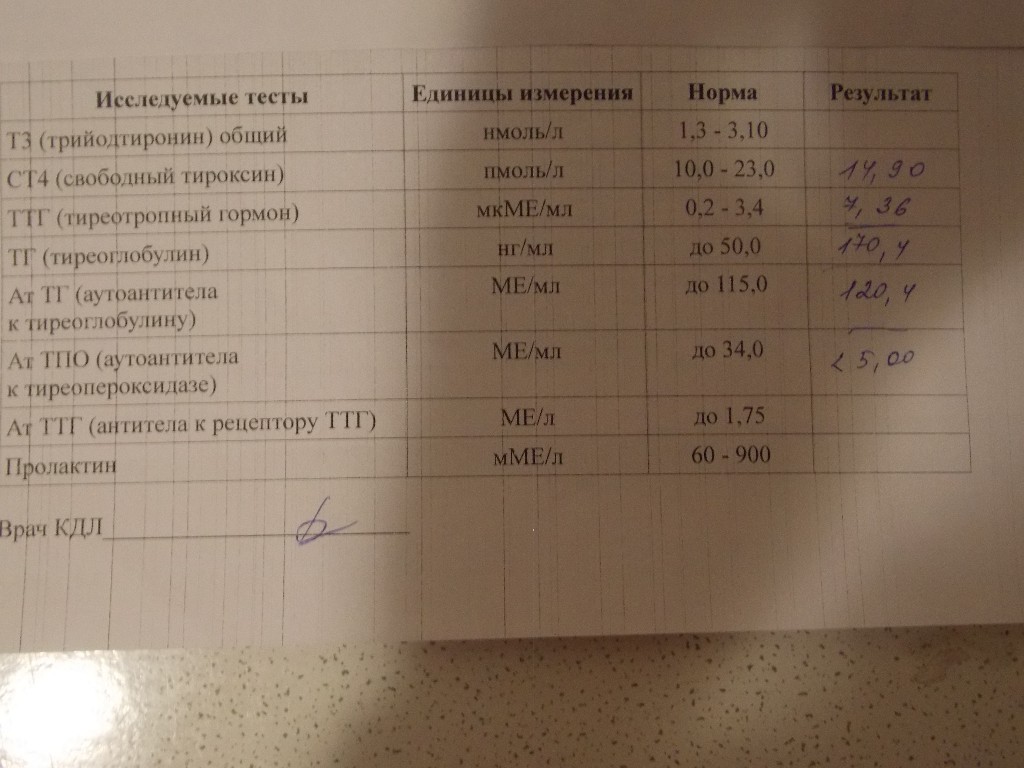 Тиреоглобулин норма у женщин по возрасту. Анализ на антитела к тиреоглобулину.