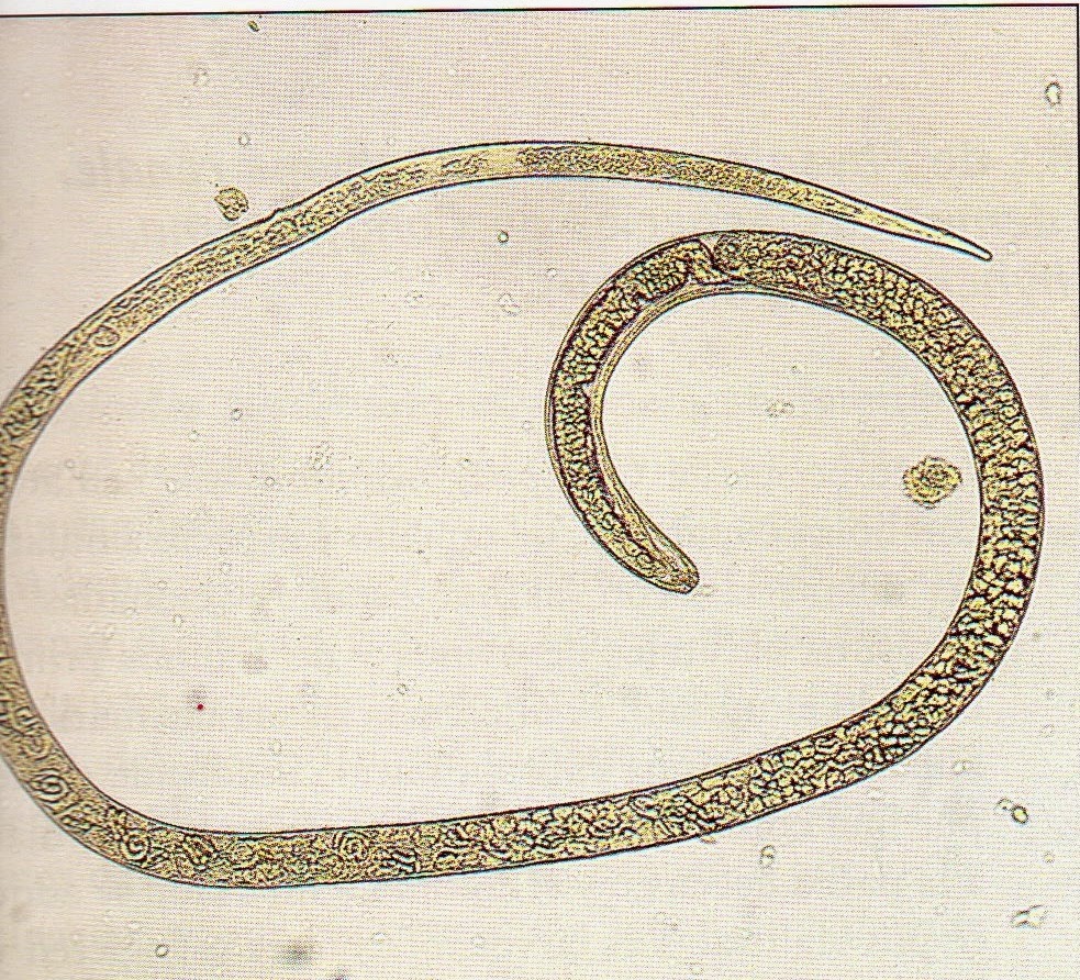 Личинки трихинеллы. Трихинелла круглые черви. Трихинелла спиральная - Trichinella spiralis. Круглые черви аскарида трихинелла.