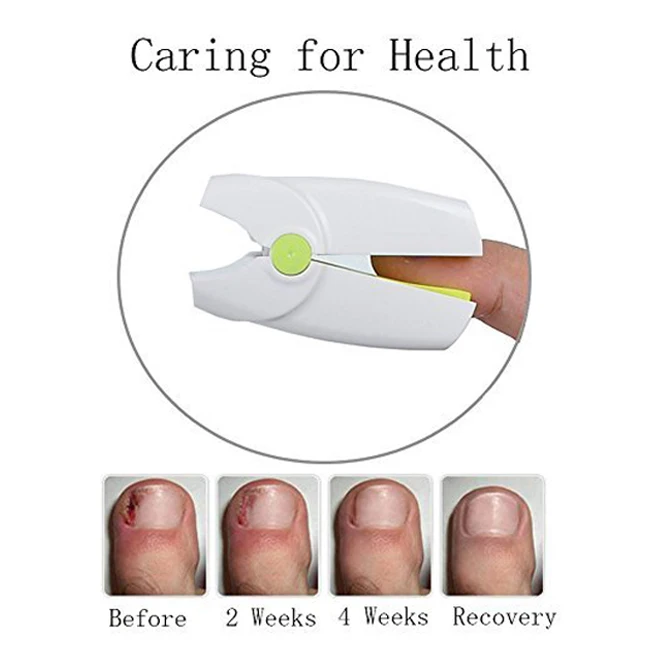 Rechargeable-Nail-Fungus-Laser-Treatment-Device-Cure-Onychomycosis-Professional-Toe-Finger-Nail-Fungus-Treatment-Machine (1)