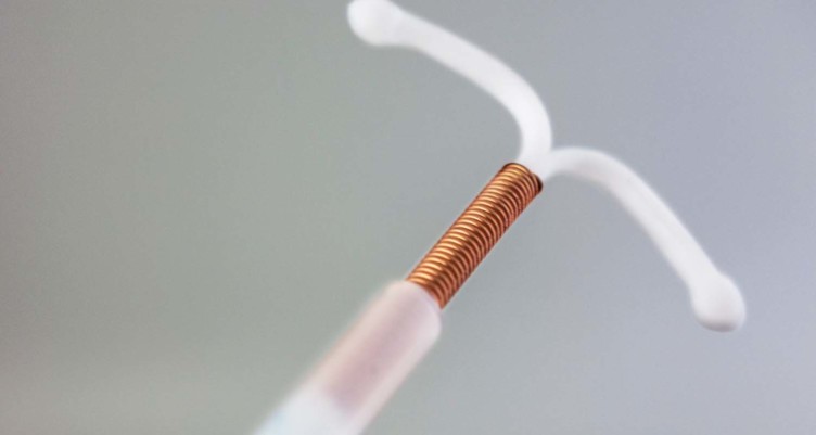 non hormonal birth control_Copper IUD