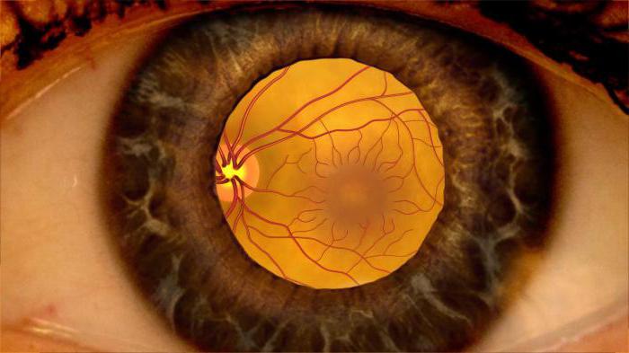 ангиопатия сосудов сетчатки обоих глаз