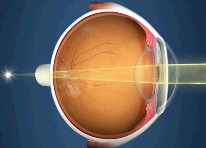 ангиопатия сетчатки 1 степени обоих глаз