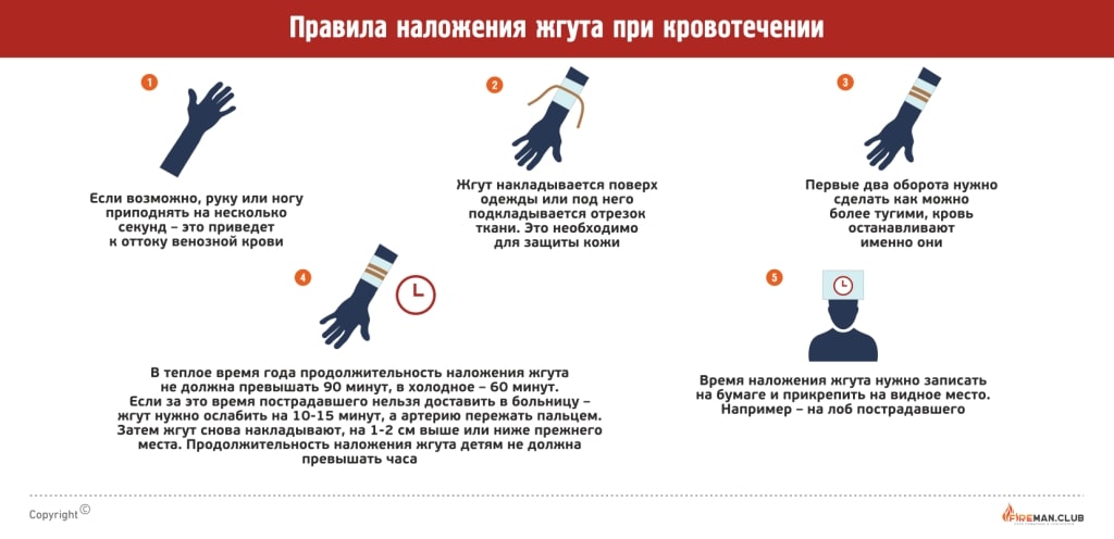 Правила наложения жгута при кровотечении