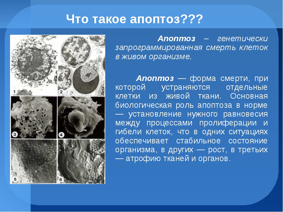 Гибель клеток некроз. Апоптоз и некроз. Апоптоз клетки. Смерть клетки апоптоз. Апоптоз это в биологии.