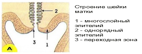 Дисплазия шейки матки