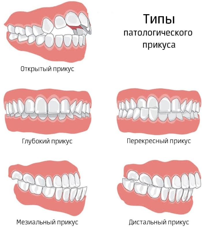 Зубы у человека. Виды, название, анатомия, функции, фото