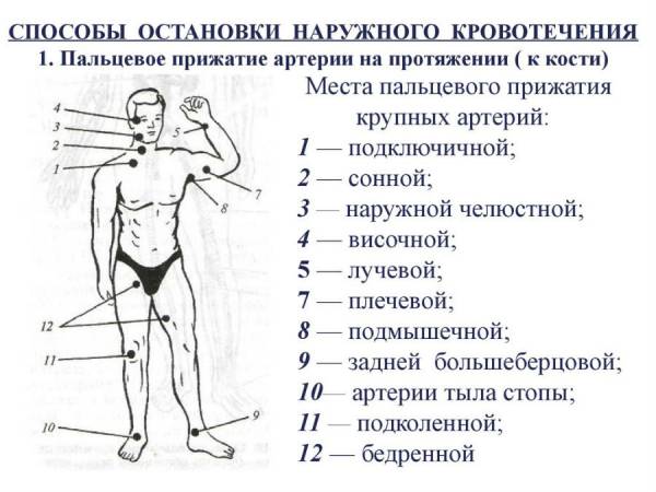 Места прижатия артерий при кровотечении