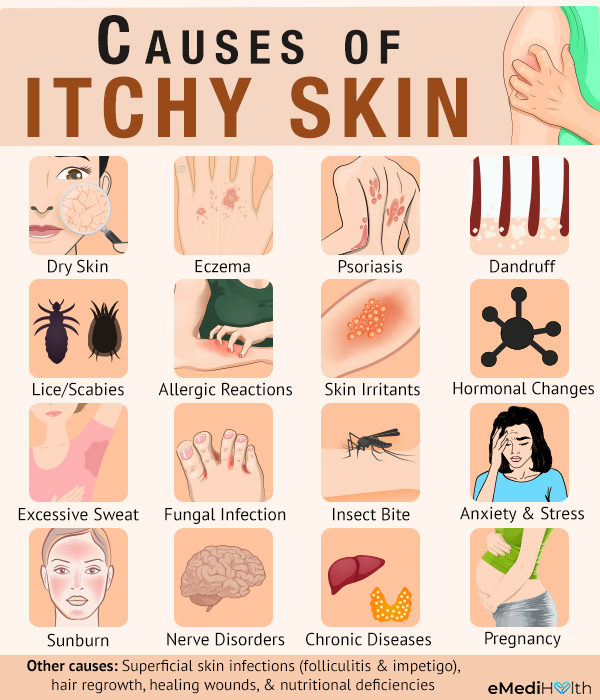 causes of itchy skin