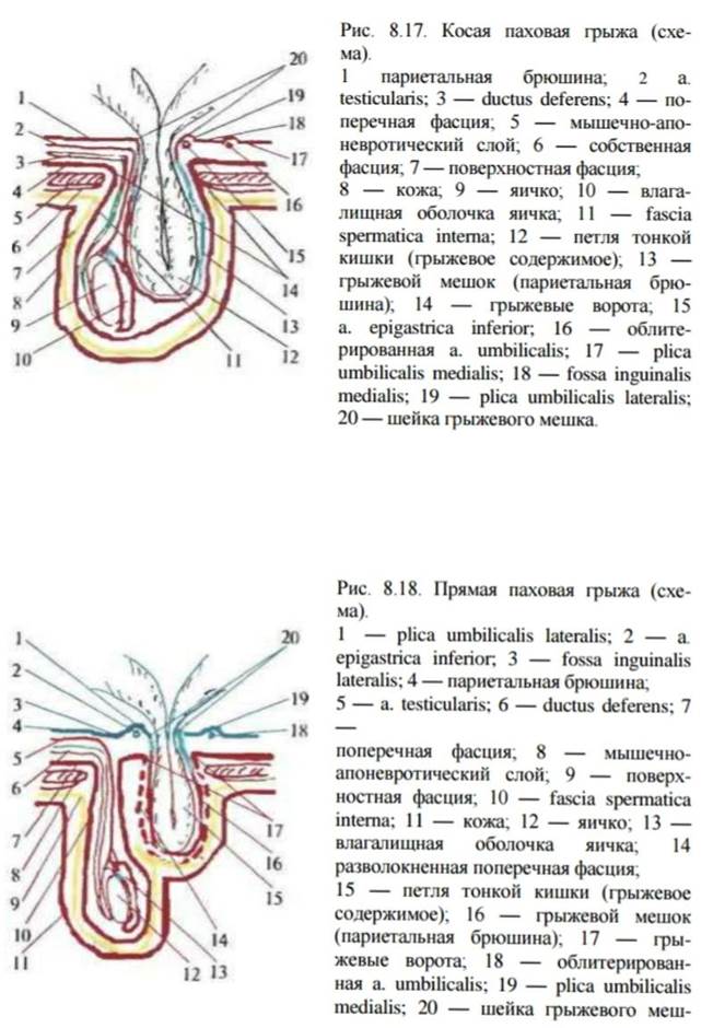 Паховая грыжа карта вызова