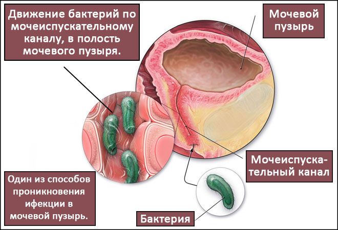 Проникновение