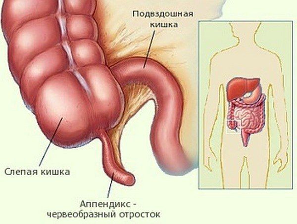 Расположение аппендикса