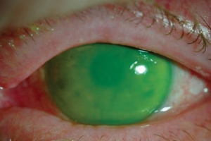 eye200870a