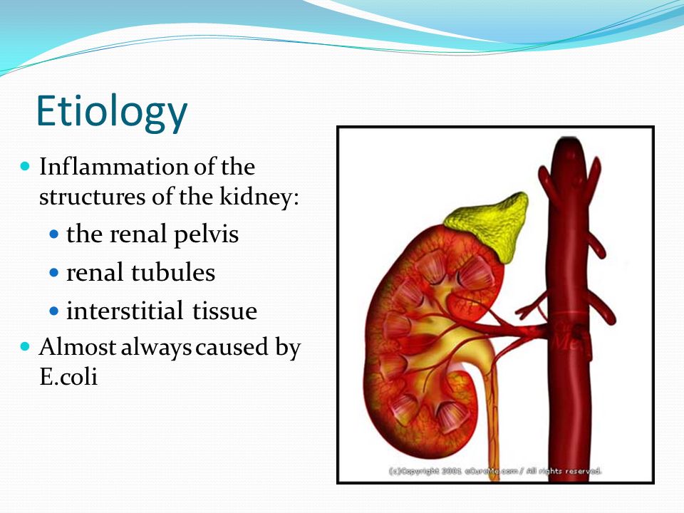 Etiology the renal pelvis renal tubules interstitial tissue