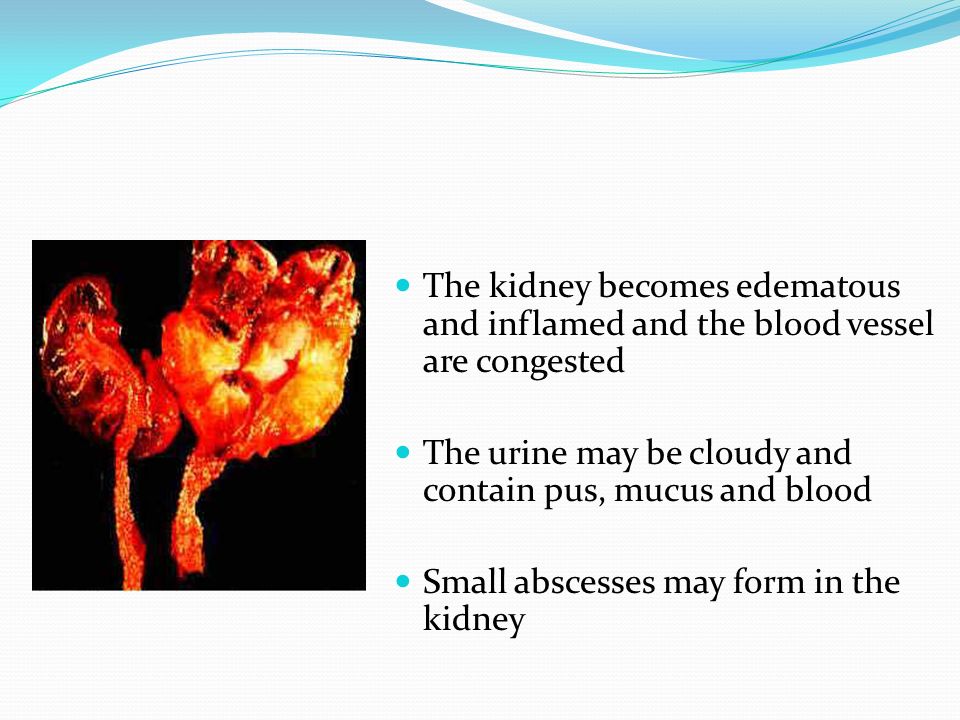 The kidney becomes edematous and inflamed and the blood vessel are congested