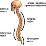 Патологические изменения в позвоночном столбе