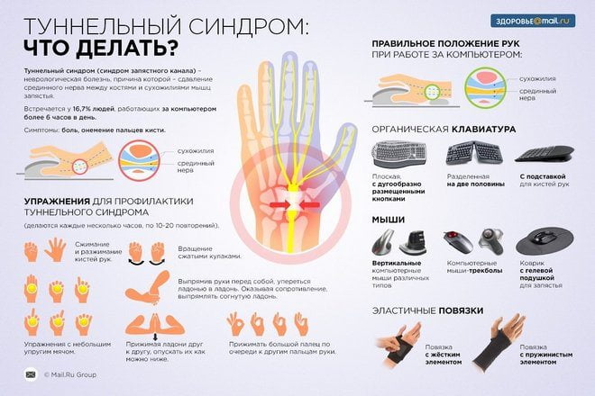 Туннельный синдром