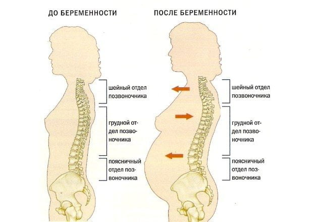 Позвоночник беременной