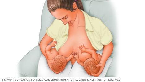 Woman breast-feeding twins with football hold