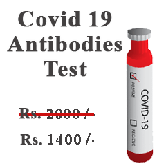 Covid Antibodies Test