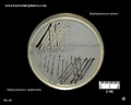 appearance of staphylococcus aureus and s.epidermidis on Baird Parker agar