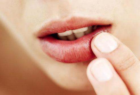 как быстро вылечить простуду на губе препараты 