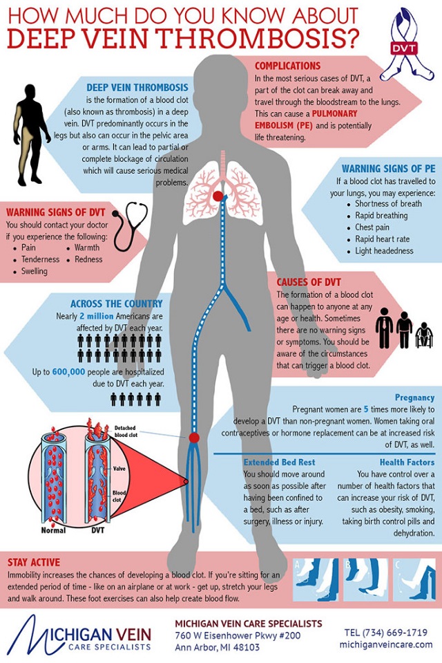 Deep-Vein-Thrombosis-Infographic
