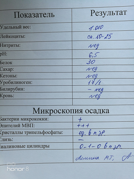 Относительная плотность мочи в общем анализе. Удельный вес мочи расшифровка.