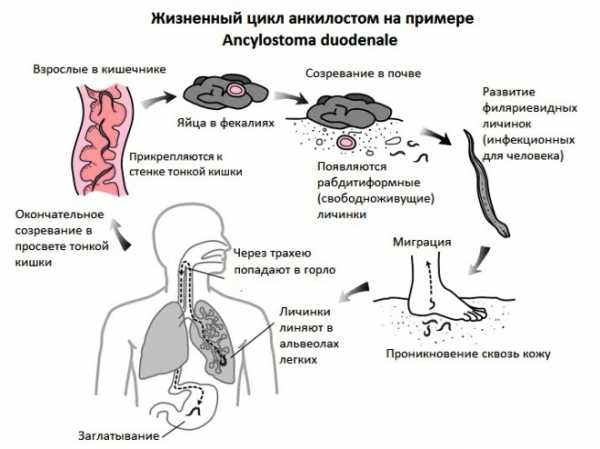 Анизакиды у человека фото