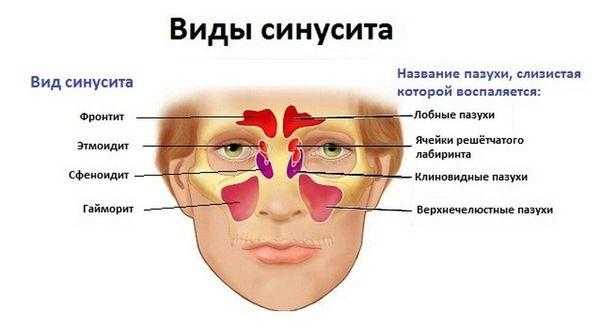 Заболевания внутреннего уха презентация