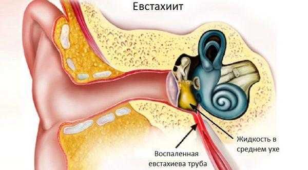 Фото болезни уха
