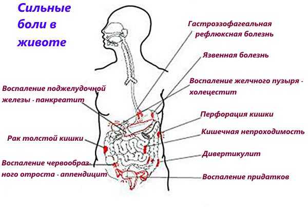 Болит бок слева внизу живота у мужчин – Что может болеть в левом боку внизу живота у мужчин?