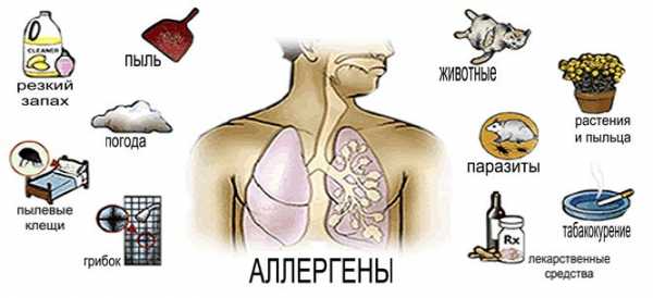 Клиническая картина бронхиальной астмы у детей