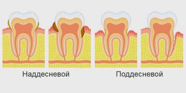 Схема как чистить зубы для детей