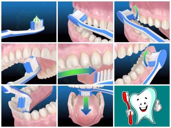 Схема чистки зубов
