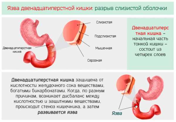 Большой дуоденальный сосочек фото