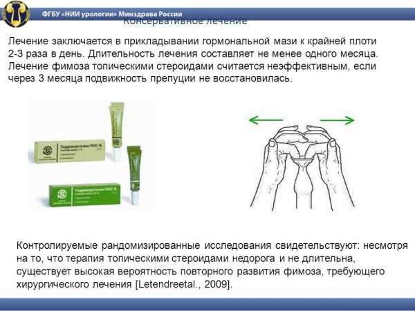 Воспаление крайней плоти у мужчин причины и лечение мазь фото