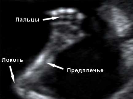 Пол на узи на 14 неделе беременности фото