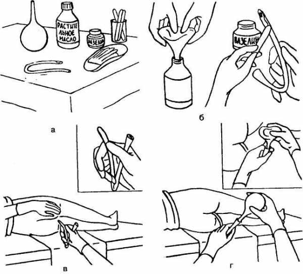Картинки как ставить клизму