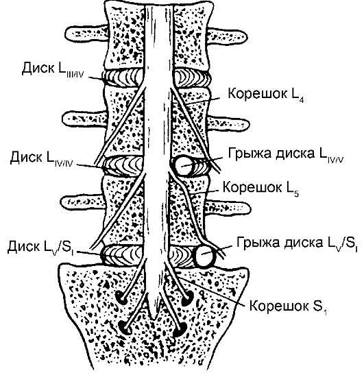 L4 l5 отдел позвоночника