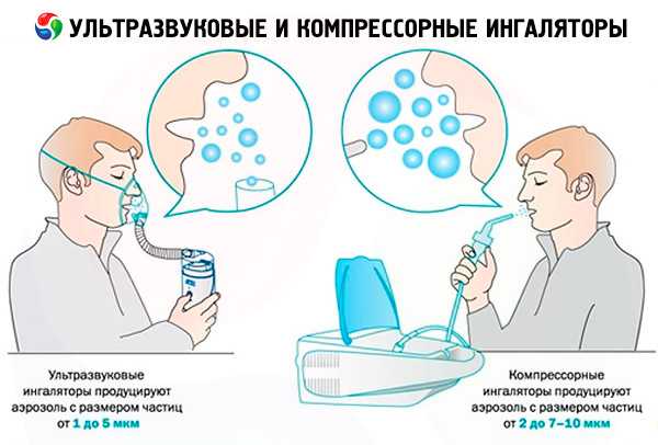 Назонекс при аденоидах у детей схема