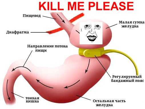 Как уменьшить размер желудка естественным