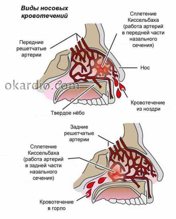 Нарушение носового клапана