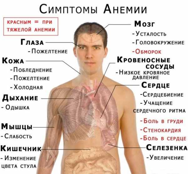 Клиническая картина железодефицитной анемии