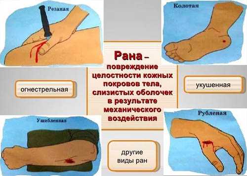 Размозженная рана картинки