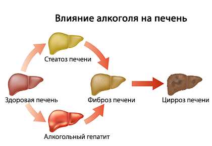 Схема лечения цирроза печени