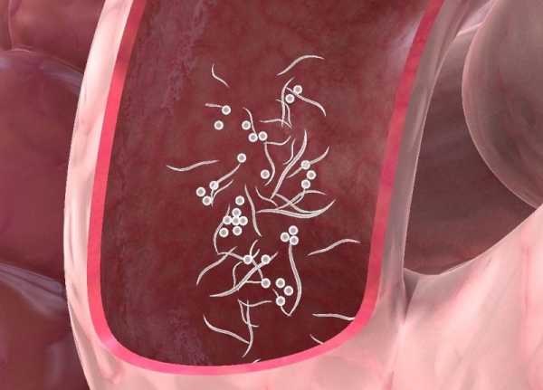 Паразиты в кишечнике фото