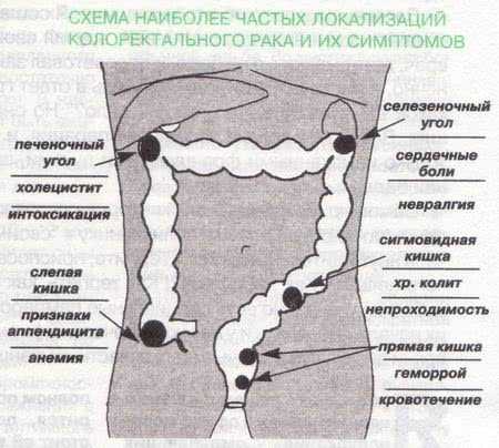 Шишка около заднего прохода у мужчин фото