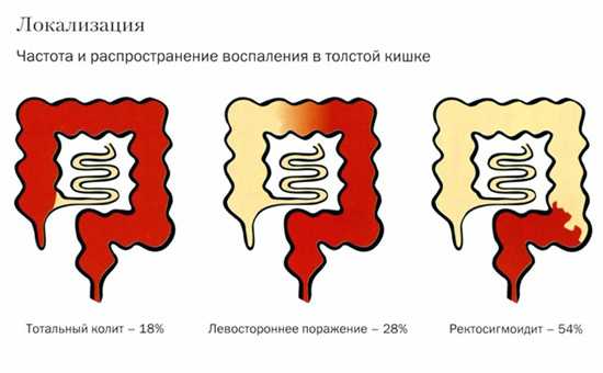 После стула кровь в заднем проходе